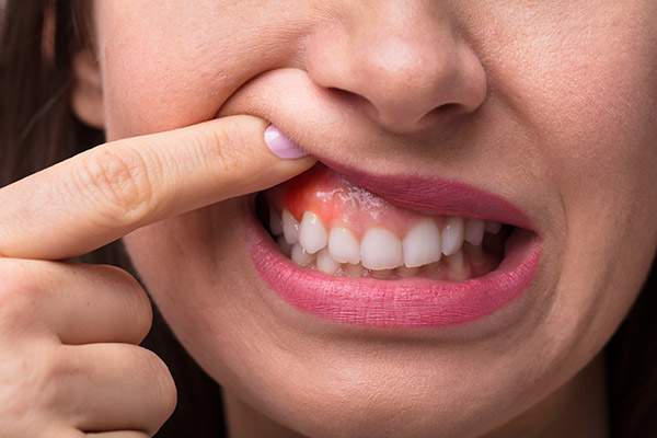 A Periodontist Explains How Gum Disease Can Harm Your Teeth And Jawbone