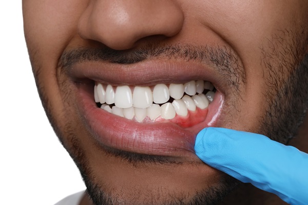 Gum Disease Prevention: Tips From A Periodontist