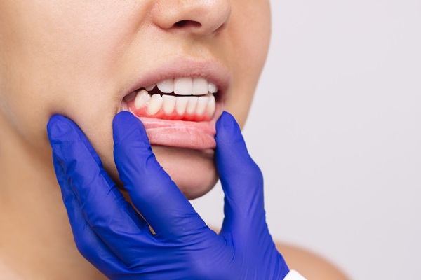 When To Seek Gum Disease Treatment From A Periodontist