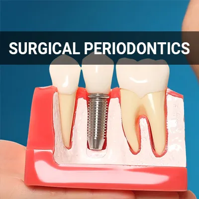 Visit our Surgical Periodontics page